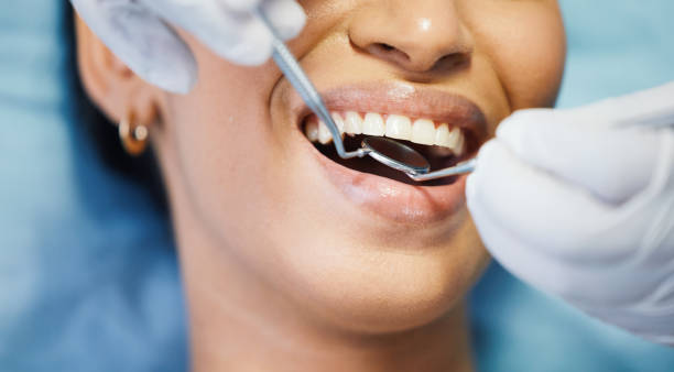 Best Emergency Root Canal Therapy in Rion Center, MA